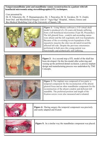 Temporomandibular joint and mandibular ramus ... - garpa