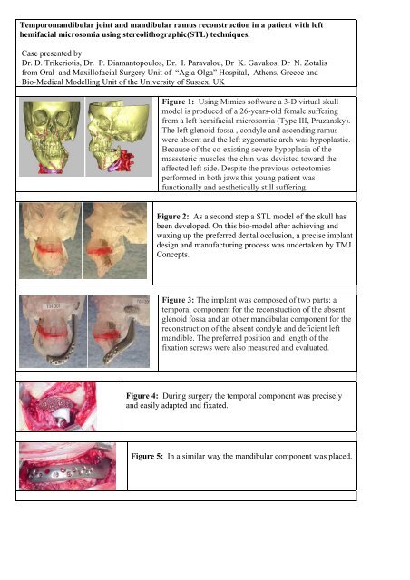 Temporomandibular joint and mandibular ramus ... - garpa