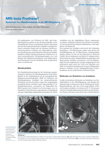 MRI trotz Prothese?