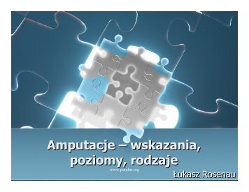 Amputacje – wskazania, poziomy, rodzaje Amputacje ... - Pandm