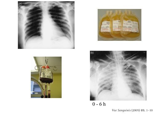 Transfusionsmedizin - Fortbildung - UniversitätsSpital Zürich