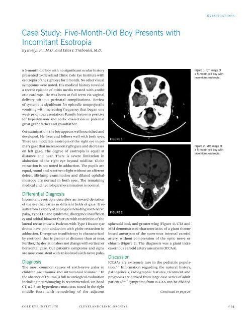 Ophthalmology Update - Cleveland Clinic