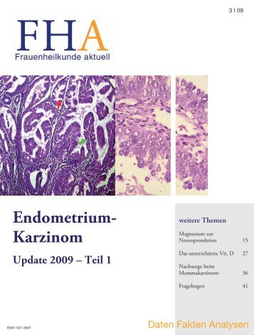 Endometrium- Karzinom - Frauenheilkunde aktuell