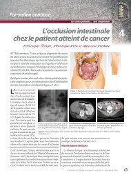 L'occlusion intestinale chez le patient atteint de cancer