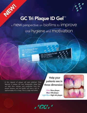 GC Tri Plaque ID Gel™ oral hygiene and motivation - GC America