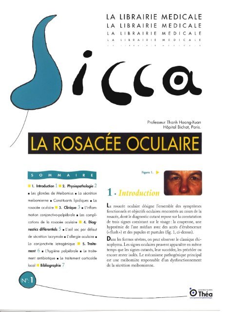 LA ROSACEE OCULAIRE - Futurophta.fr