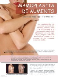 MAMOPLASTIA DE AUMENTO