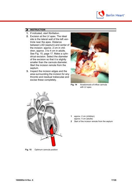 Instructions for use: Ikus - Berlin Heart