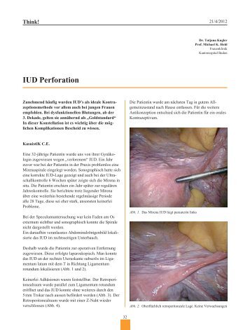 IUD Perforation - Frauenheilkunde aktuell