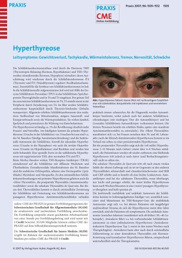 Hyperthyreose - Fortbildung - UniversitätsSpital Zürich