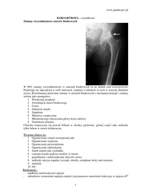 www.pandm.prv.pl 1 KOKSARTROZA - coxarthrosis Zmiany ...