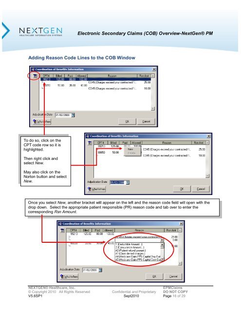 Overview of Electronic Secondary Claims (COB)