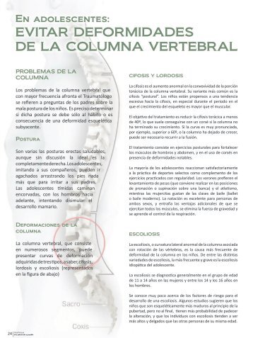 EVITAR DEFORMIDADES DE LA COLUMNA VERTEBRAL