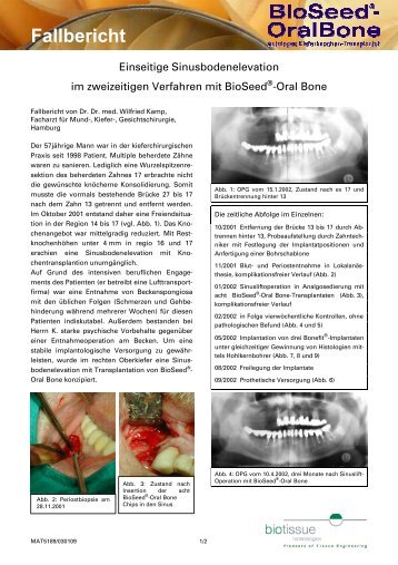 Fallbericht - Biotissue Technologies Gmbh