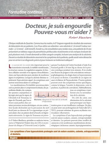 Docteur, je suis engourdie Pouvez-vous m'aider?