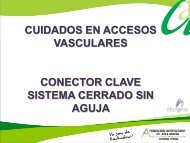 beneficios conector clave