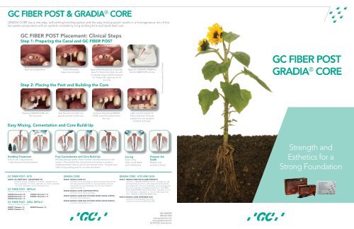 GC FIBER POST GRADIA® CORE - GC America