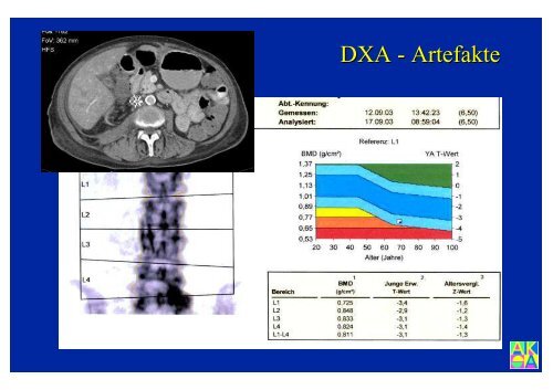 Download PowerPoint-Präsentation - Institut für Radiologie ...