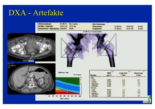 Download PowerPoint-Präsentation - Institut für Radiologie ...