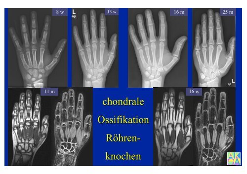 Download PowerPoint-Präsentation - Institut für Radiologie ...