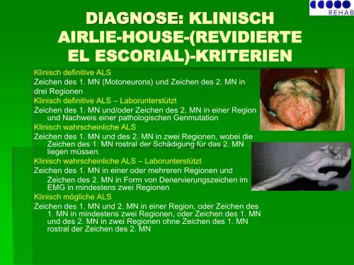 Allgemeines zur ALS - ALS-Vereinigung.ch