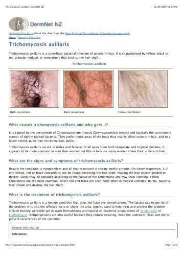 Trichomycosis axillaris. DermNet NZ