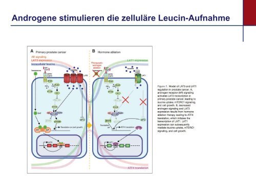 Akne: eine epidemische Hauterkrankung durch westliche ...