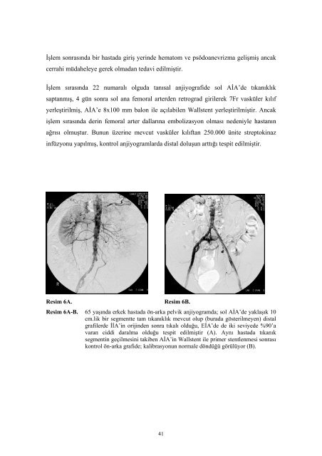 başkent üniversitesi tıp fakültesi radyoloji anabilim dalı aortoiliyak