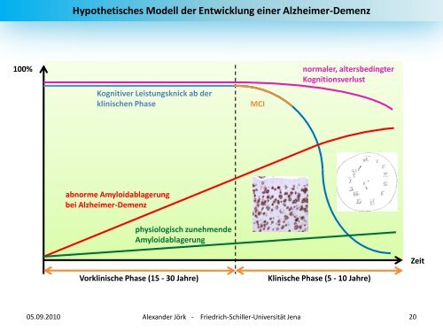 Demenz - alexander-joerk.de