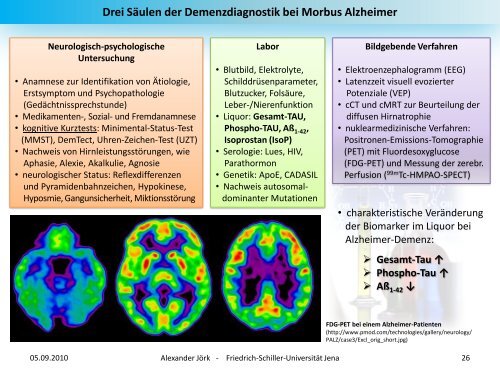 Demenz - alexander-joerk.de