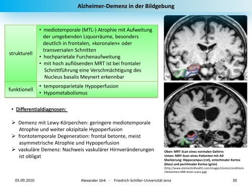 Demenz - alexander-joerk.de