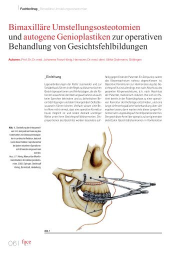 FA0111_06-14_Hoenig (Page 1)