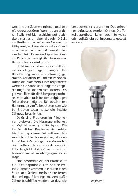 Implantatratgeber 2013 - Zahnärzte Dr. Schrott & Partner