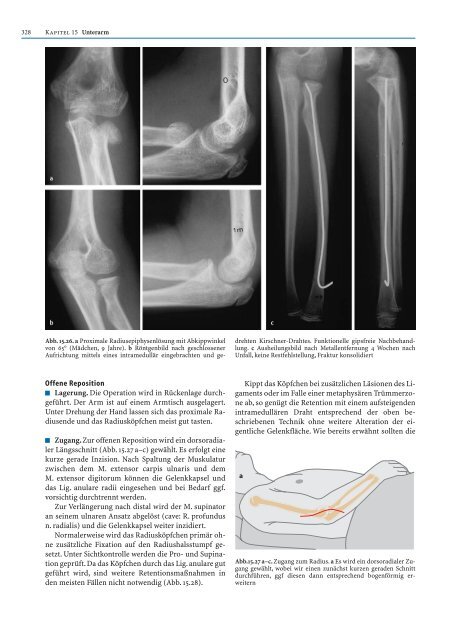 Probekapitel [.pdf - ca. 5233 kb] - Minerva KG Gude