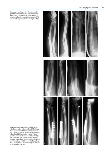 Probekapitel [.pdf - ca. 5233 kb] - Minerva KG Gude