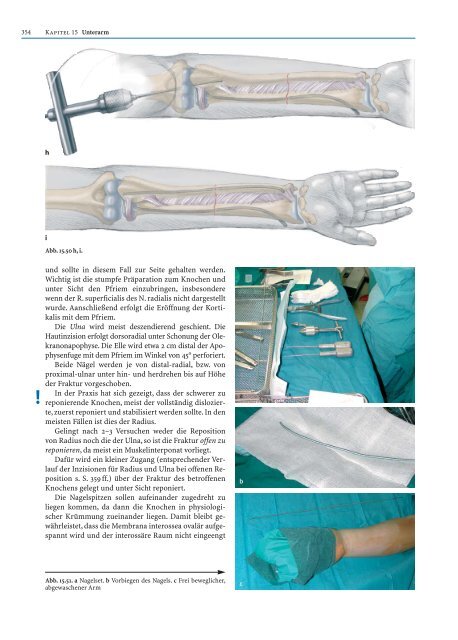 Probekapitel [.pdf - ca. 5233 kb] - Minerva KG Gude