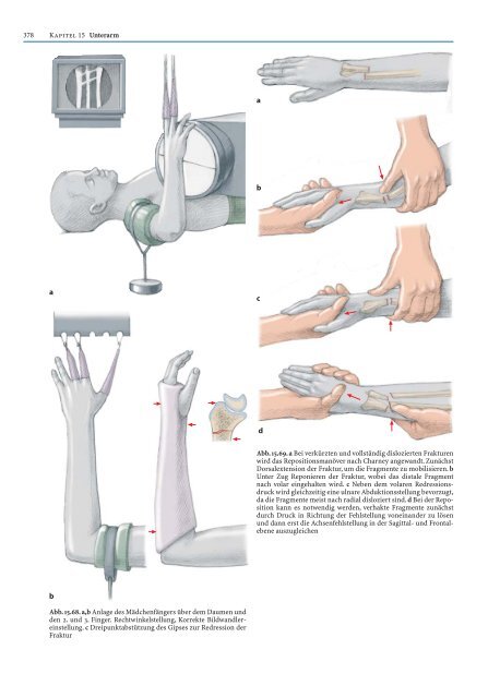 Probekapitel [.pdf - ca. 5233 kb] - Minerva KG Gude