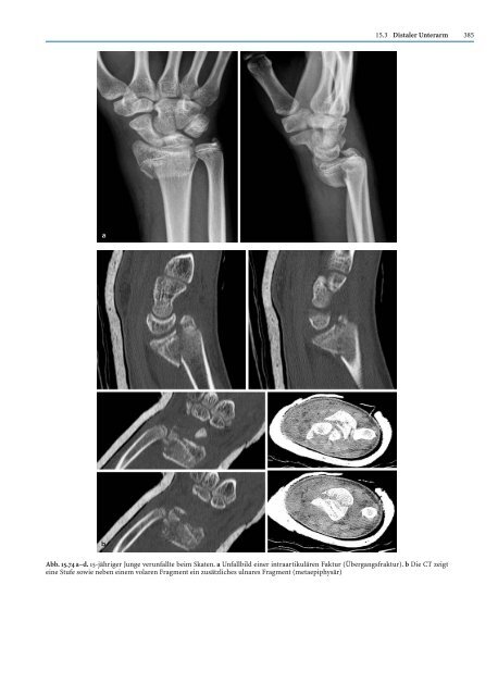 Probekapitel [.pdf - ca. 5233 kb] - Minerva KG Gude