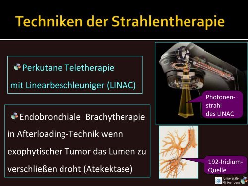 Vorlesung 9. Semester Bronchial-CA - Klinik für Strahlentherapie ...