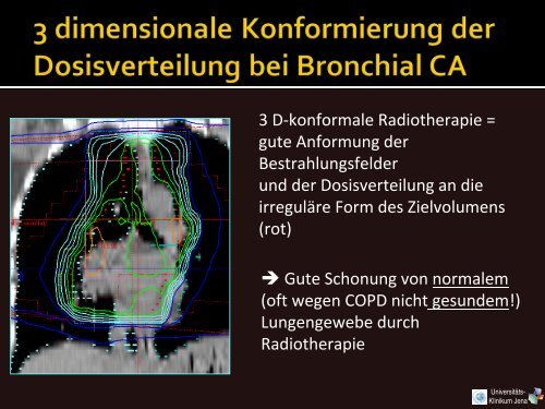 Vorlesung 9. Semester Bronchial-CA - Klinik für Strahlentherapie ...