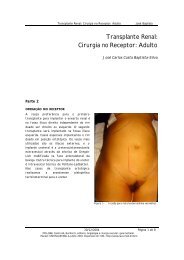 Transplante Renal: Cirurgia no Receptor: Adulto - Lava Vascular