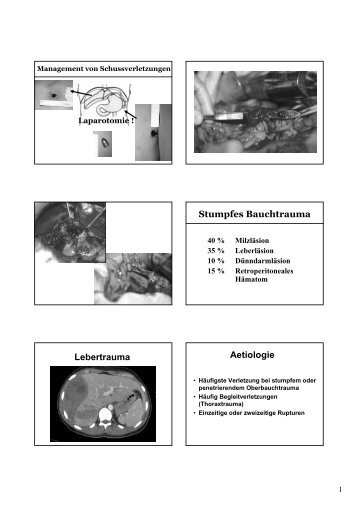 Abdominelles Trauma Teil 2 - gastroenterology-hepatology-basel