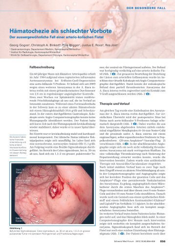 Hämatochezie als schlechter Vorbote - Swiss Medical Forum