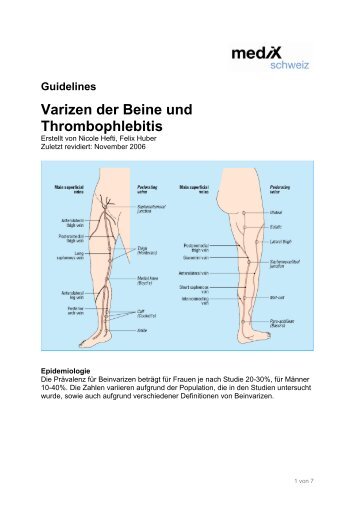 Varizen Der Beine Und Thrombophlebitis