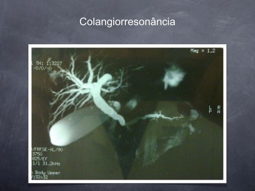 Hospital Cardoso Fontes Cirurgia Geral