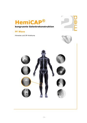 HemiCAP PF Wave (OP-Anleitung, Deutsch - PDF, 2.524 KB) - 2med