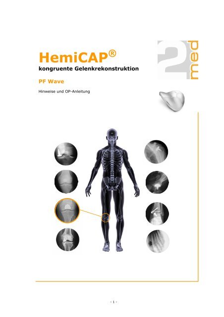 HemiCAP PF Wave (OP-Anleitung, Deutsch - PDF, 2.524 KB) - 2med