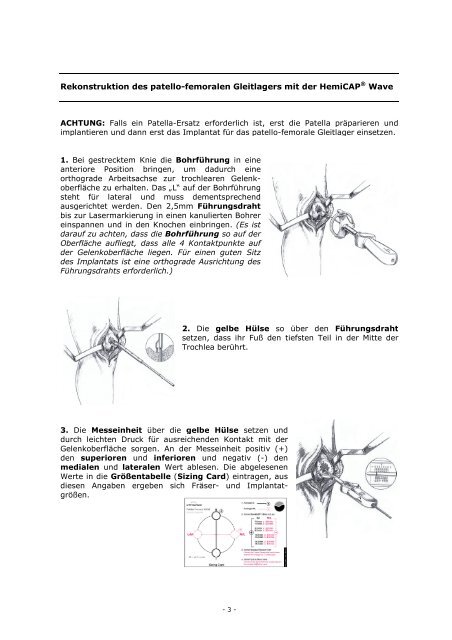 HemiCAP PF Wave (OP-Anleitung, Deutsch - PDF, 2.524 KB) - 2med