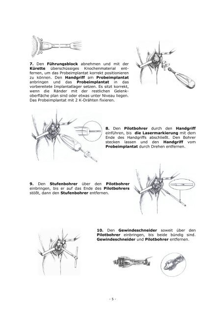 HemiCAP PF Wave (OP-Anleitung, Deutsch - PDF, 2.524 KB) - 2med