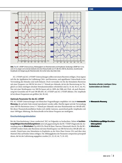 Die Ableitung zervikaler und okulärer vestibulär evozierter ...